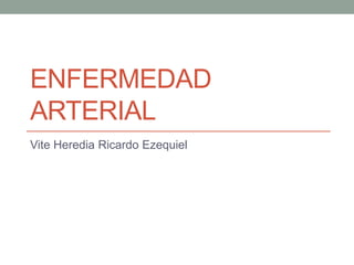 ENFERMEDAD
ARTERIAL
Vite Heredia Ricardo Ezequiel
 