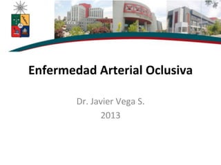 Enfermedad	
  Arterial	
  Oclusiva	
  
Dr.	
  Javier	
  Vega	
  S.	
  
2013	
  
 