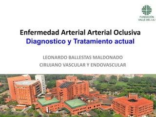 Enfermedad Arterial Arterial Oclusiva
Diagnostico y Tratamiento actual
LEONARDO BALLESTAS MALDONADO
CIRUJANO VASCULAR Y ENDOVASCULAR
 