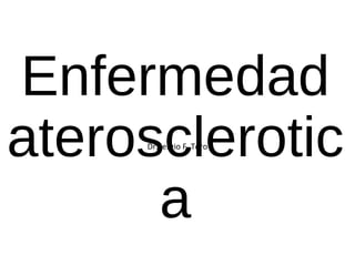 Enfermedad
aterosclerotic
a
Dr.Sergio F. Toro
 