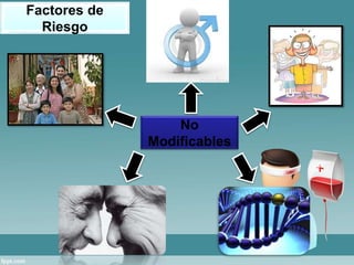 No 
Modificables 
Factores de 
Riesgo 
 