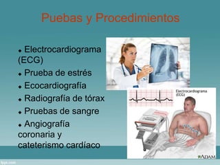 Puebas y Procedimientos 
 Electrocardiograma 
(ECG) 
 Prueba de estrés 
 Ecocardiografía 
 Radiografía de tórax 
 Pruebas de sangre 
 Angiografía 
coronaria y 
cateterismo cardíaco 
 