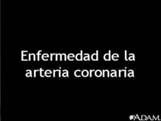 ENFERMEDAD CORONARIA 
 
