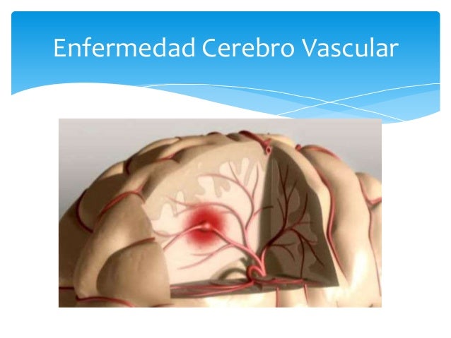 Enfermedad cardiovascular en la diabetes mellitus Enfermedad cardiovascular en la diabetes mellitus