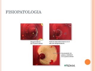 FISIOPATOLOGIA 