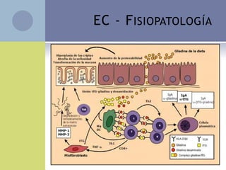EC - F ISIOPATOLOGÍA
 