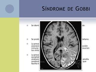 S ÍNDROME                  DE       G OBBI

   Se identificó por primera vez en 1991 por Giuseppe Gobbi.
                                    EC

             CALCIF OCCIPITALES             EPILEPSIA
   Se produce casi exclusivamente en personas de origen italiano.

   La presencia de anticuerpos anti-gliadina en el LCR y la
    asociación con los genes HLA de clase II, sugiere una reacción
    inmune procede del intestino, pero no se sabe por qué ocurren
    los síntomas neurológicos.

   La presencia de calcificaciones bilaterales en los lóbulos
    occipitales es una de las principales características del
    síndrome. Además, los pacientes muestran ausencia de atrofia
    cerebral y falta de refuerzo con material de contraste lo que
    facilita los diagnósticos diferenciales.
 
