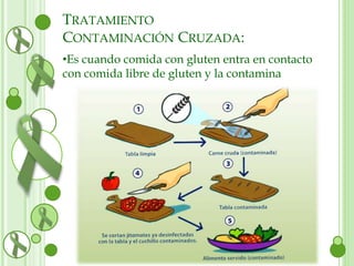 TRATAMIENTO 
CONTAMINACIÓN CRUZADA: 
•Es cuando comida con gluten entra en contacto 
con comida libre de gluten y la contamina 
 