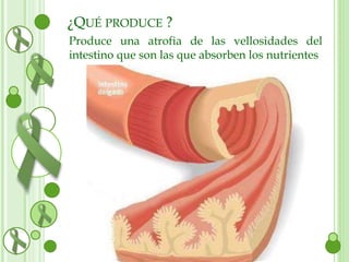 ¿QUÉ PRODUCE ? 
Produce una atrofia de las vellosidades del 
intestino que son las que absorben los nutrientes 
 