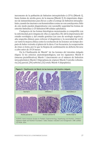 incremento de la población de linfocitos intraepiteliales (>25%) [Marsh 1],
hasta formas de atrofia grave de la mucosa [Marsh 3]. Es importante dispo­
ner de inmunotinciones para llevar a cabo el contaje de linfocitos intraepite­
liales, cuando las tinciones con hematoxilina-eosina no son concluyentes. Sólo
de este modo pueden diagnosticarse con razonable seguridad las formas de
enteritis linfocítica (>25 linfocitos/100 células epiteliales).
       Cualquiera de las formas histológicas mencionadas es compatible con
la enfermedad, pero ninguna de ellas es específica. De ahí la importancia del
estudio serológico y del estudio genético (en caso de serología negativa y
alta sospecha clínica), para reforzar el diagnóstico y la necesidad de verifi­
car tanto la mejora clínica como la resolución de las lesiones un tiempo des­
pués de haber retirado el gluten de la dieta. Con frecuencia, la recuperación
de éstas es lenta, por lo que la biopsia de confirmación no debería llevarse
a cabo antes de 18-24 meses.
       En la Clasificación de Marsh15 de las lesiones del intestino delgado
(figura 2) los criterios anatomopatológicos, son los siguientes: Marsh 0
(mucosa preinfiltrativa); Marsh 1 (incremento en el número de linfocitos
intraepiteliales); Marsh 2 (hiperplasia de criptas); Marsh 3 (atrofia vellosita­
ria [3a] parcial, [3b] subtotal, [3c] total); Marsh 4 (hipoplasia).


 Figura 2. Clasificación de Marsh de las lesiones del intestino delgado




            Normal 0                         Infiltrativa 1                   Hiperplásica 2




        Atrofia parcial 3a               Atrofia subtotal 3b                  Atrofia total 2c

 FUENTE: North American Society for Pediatric Gastroenterology, Hepathology and Nutrition, Children’s
 Digestive Health and Nutrition Foundation. Celiac Disease: evaluation and management. CME certified
 CD-ROM. 2004.




DIAGNÓSTICO PRECOZ DE LA ENFERMEDAD CELÍACA                                                             27
 