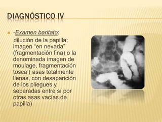 DIAGNÓSTICO IV
   -Examen baritato:
    dilución de la papilla;
    imagen “en nevada”
    (fragmentación fina) o la
    denominada imagen de
    moulage, fragmentación
    tosca ( asas totalmente
    llenas, con desaparición
    de los pliegues y
    separadas entre sí por
    otras asas vacías de
    papilla)
 