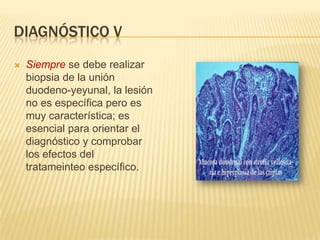 DIAGNÓSTICO V
   Siempre se debe realizar
    biopsia de la unión
    duodeno-yeyunal, la lesión
    no es específica pero es
    muy característica; es
    esencial para orientar el
    diagnóstico y comprobar
    los efectos del
    tratameinteo específico.
 