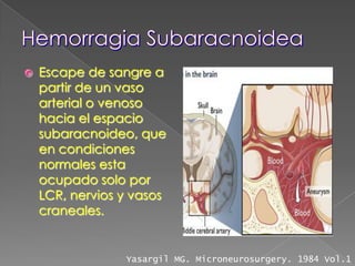    Escape de sangre a
    partir de un vaso
    arterial o venoso
    hacia el espacio
    subaracnoideo, que
    en condiciones
    normales esta
    ocupado solo por
    LCR, nervios y vasos
    craneales.


                 Yasargil MG. Microneurosurgery. 1984 Vol.1
 