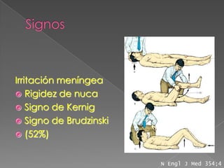Irritación meníngea
 Rigidez de nuca
 Signo de Kernig
 Signo de Brudzinski
 (52%)


                        N Engl J Med 354;4
 