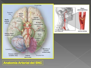 Anatomía Arterial del SNC
 