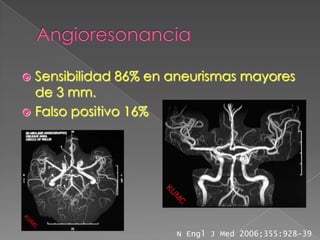 Sensibilidad 86% en aneurismas mayores
  de 3 mm.
 Falso positivo 16%




                      N Engl J Med 2006;355:928-39
 