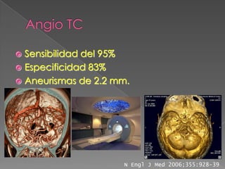  Sensibilidad del 95%
 Especificidad 83%
 Aneurismas de 2.2 mm.




                     N Engl J Med 2006;355:928-39
 