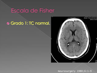    Grado 1: TC normal.




                          Neurosurgery 1980;6:1-9
 