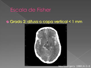    Grado 2: difusa o capa vertical < 1 mm




                             Neurosurgery 1980;6:1-9
 