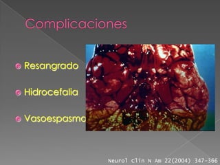    Resangrado

   Hidrocefalia

   Vasoespasmo



                   Neurol Clin N Am 22(2004) 347-366
 