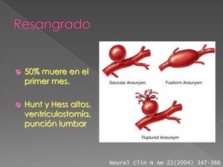    50% muere en el
    primer mes.

   Hunt y Hess altos,
    ventriculostomía,
    punción lumbar



                         Neurol Clin N Am 22(2004) 347-366
 