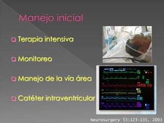    Terapia intensiva

   Monitoreo

   Manejo de la vía área

   Catéter intraventricular


                          Neurosurgery 53:123-135, 2003
 