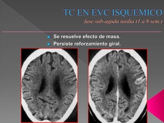    Se resuelve efecto de masa.
   Persiste reforzamiento giral.
 