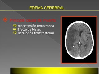 EDEMA CEREBRAL


   Principal causa de muerte
      Hipertensión Intracraneal
      Efecto de Masa,
      Herniación transtentorial
 