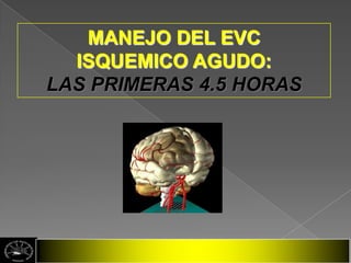 MANEJO DEL EVC
  ISQUEMICO AGUDO:
LAS PRIMERAS 4.5 HORAS
 