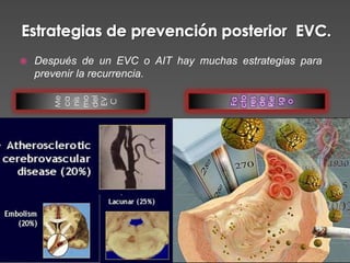    Después de un EVC o AIT hay muchas estrategias para
    prevenir la recurrencia.




                                      cto
       mo
       Me



       del




                                      Rie
       ca




                                      de
                                      res
       EV
       nis




                                      Fa




                                      sg
        C




                                       o
 