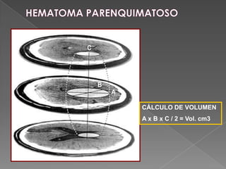 CÁLCULO DE VOLUMEN
A x B x C / 2 = Vol. cm3
 
