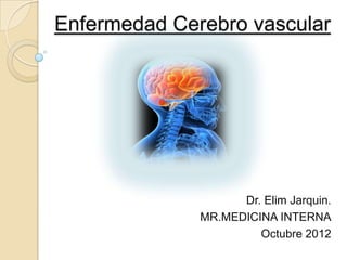 Enfermedad Cerebro vascular




                    Dr. Elim Jarquin.
              MR.MEDICINA INTERNA
                       Octubre 2012
 