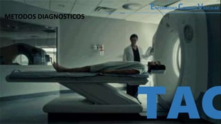 TAC
METODOS DIAGNOSTICOS
ENFERMEDAD CEREBRO VASCULAR
 