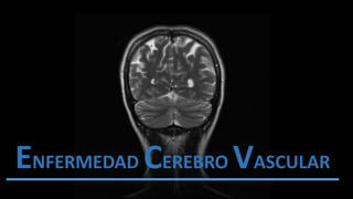 ENFERMEDAD CEREBRO VASCULAR
 