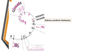 Edema cerebral citotoxico
 