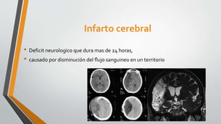 Infarto cerebral
• Deficit neurologico que dura mas de 24 horas,
• causado por disminución del ﬂujo sanguineo en un territorio
 