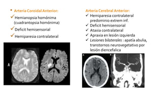 • Arteria Coroidal Anterior:
Hemianopsia homónima
(cuadrantopsia homónima)
Deficit hemisensorial
Hemiparesia contralateral
Arteria Cerebral Anterior:
 Hemiparesia contralateral
predominio extrem inf.
 Deficit hemisensorial
 Ataxia contralateral
 Apraxia en lesión izquierda
 Lesiones bilaterales : apatía abulia,
transtornos neurovegetativo por
lesión diencefalica
 