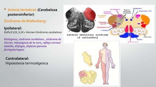 • ArteriaVertebral: (Cerebelosa
posteroinferior)
Sindrome de Wallenberg:
Ipsilateral:
DeficitV,IX, X,XI + Horner+Sindrome cerebeloso
Nistagmus, síndrome cerebeloso , síndrome de
Horner, Hipoalgesia de la cara, reflejo corneal
abolido, disfagia, disfasia (parasia
faringolaringea)
Contralateral:
Hipoestesia termoalgesica
 