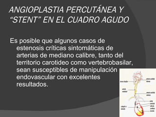 ANGIOPLASTIA PERCUTÁNEA Y “STENT” EN EL CUADRO AGUDO Es posible que algunos casos de estenosis críticas sintomáticas de arterias de mediano calibre, tanto del territorio carotideo como vertebrobasilar, sean susceptibles de manipulación endovascular con excelentes resultados. 
