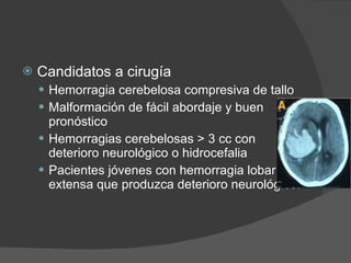 Candidatos a cirugía Hemorragia cerebelosa compresiva de tallo Malformación de fácil abordaje y buen pronóstico  Hemorragias cerebelosas > 3 cc con deterioro neurológico o hidrocefalia Pacientes jóvenes con hemorragia lobar extensa que produzca deterioro neurológico. 