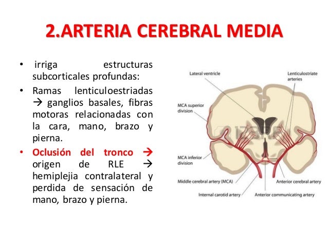 síntomas de oclusión de la arteria cerebelosa inferior posterior de diabetes síntomas de oclusión de la arteria cerebelosa inferior posterior de diabetes