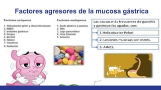 Factores agresores de la mucosa gástrica
 