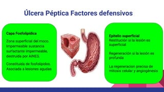 Úlcera Péptica Factores defensivos
Capa Fosfolipídica
Zona superficial del moco.
Impermeable sustancia
surfactante impermeable,
destruida por AINES.
Constituida de fosfolípidos.
Asociada a lesiones agudas
Epitelio superficial
Restitución si la lesión es
superficial
Regeneración si la lesión es
profunda
La regeneracion precisa de
mitosis celular y angiogénesis
 