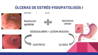 ÚLCERAS DE ESTRÉS-FISIOPATOLOGÍA I
EQUILIBRIO = SALUD
Apositosis
celular
DESEQUILIBRIO = LESIÓN MUCOSA
Restitución
epitelial
GASTRITIS ULCERA
 