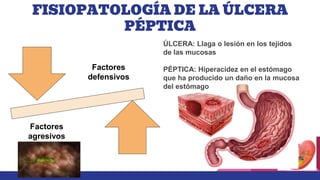 FISIOPATOLOGÍA DE LA ÚLCERA
PÉPTICA
Factores
agresivos
Factores
defensivos
ÚLCERA: Llaga o lesión en los tejidos
de las mucosas
PÉPTICA: Hiperacidez en el estómago
que ha producido un daño en la mucosa
del estómago
 