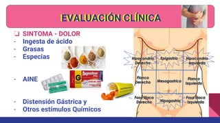 EVALUACIÓN CLÍNICA
❏ SINTOMA - DOLOR
- Ingesta de ácido
- Grasas
- Especias
- AINE
- Distensión Gástrica y
- Otros estímulos Químicos
EVALUACIÓN CLÍNICA
 