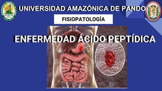 ENFERMEDAD ÁCIDO PEPTÍDICA
FISIOPATOLOGÍA
UNIVERSIDAD AMAZÓNICA DE PANDO
UNIVERSIDAD AMAZÓNICA DE PANDO
ENFERMEDAD ÁCIDO PEPTÍDICA
 