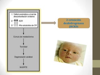 2-cetoácido
deshidrogenasa
(BCKD)
 