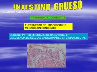TRASTORNOS CONGÈNITOS
ENFERMEDAD DE HIRSCHSPRUNG
MEGACOLON CONGÈNITO
ANATOMÌA PATOLÒGICA
EL DX DEFINITIVO SE ESTABLECE BASÀNDOSE EN
LA AUSENCIA DE CÈLULAS GANGLIONARES EN BIOPSIA RECTAL.
 