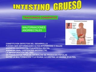 TRASTORNOS CONGÈNITOS
MALFORMACIONES
ANORRECTALES
CONSTITUYEN DEFECTOS DEL DESARROLLO
PUEDEN SER DEFORMIDADES ALTAS-INTERMEDIAS O BAJAS
AGENESIA ANORRECTAL Y LA ATRESIA RECTAL
AGENESIA ANAL Y ESTENOSIS ANORRECTAL
LA IMPERFORACIÒN DEL ANO
EN TODOS ESTOS TIPOS DE ANOMALÌAS SE PRODUCEN FÌSTULAS
ENTRE LA MALFORMACIÒN Y LA VEJIGA, LA URETRA, LA VAGINA, O LA PIEL
 